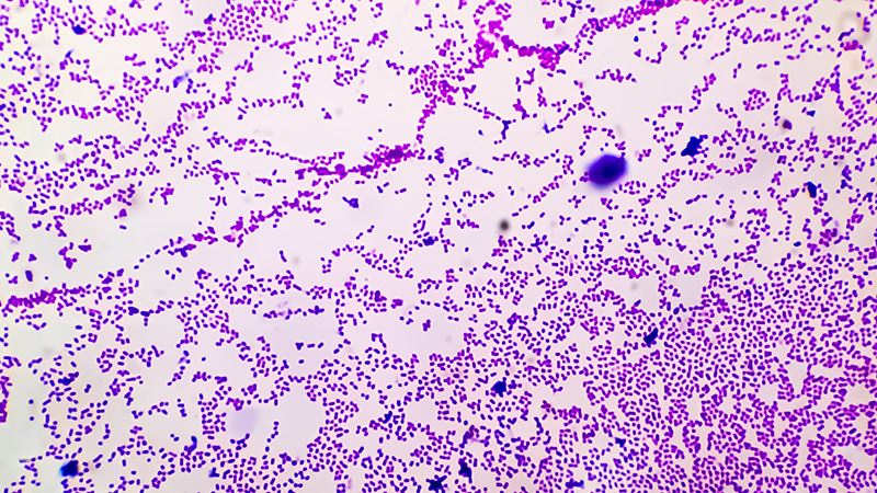 Gram stain